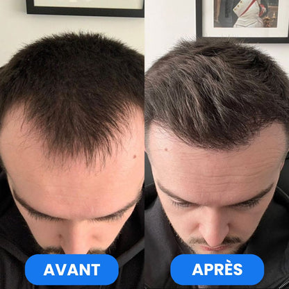 Sérum Roll-On Activateur de Pousse